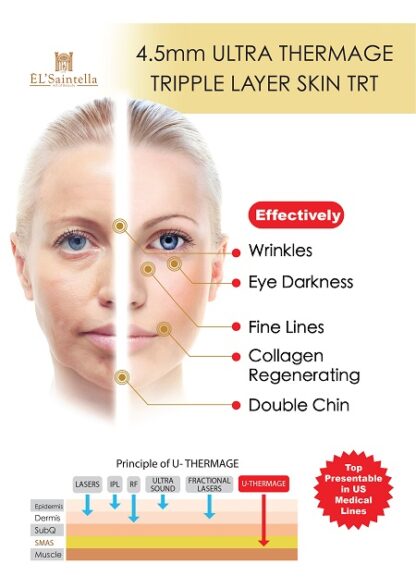 Ultra Thermerge Treatments